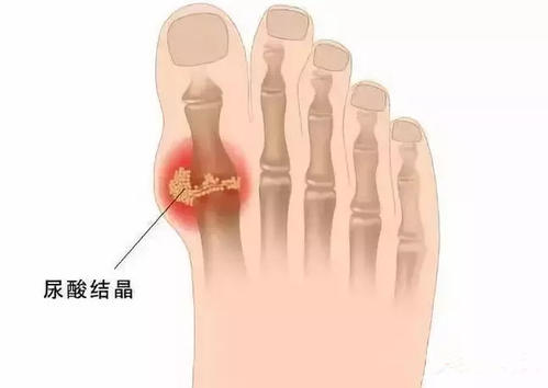 肾能症状功能好肝功能正常吗_肾能症状功能好肝功能异常_肾功能及肝功能不好的症状