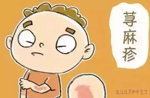 慢性荨麻疹中医治疗医案一则