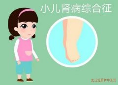 湖北省中医儿科厉害的医生王大宪：中医治疗小儿肾病综合征有效果吗?