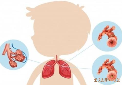 儿科名中医王大宪教授:小儿寒性哮喘出现咳嗽粘沫状痰吃什么中药有用?