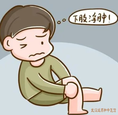武汉鹦鹉大道肾病科老中医门诊部:双下肢水肿做检查无异常胸闷口干苦中药怎么治好?