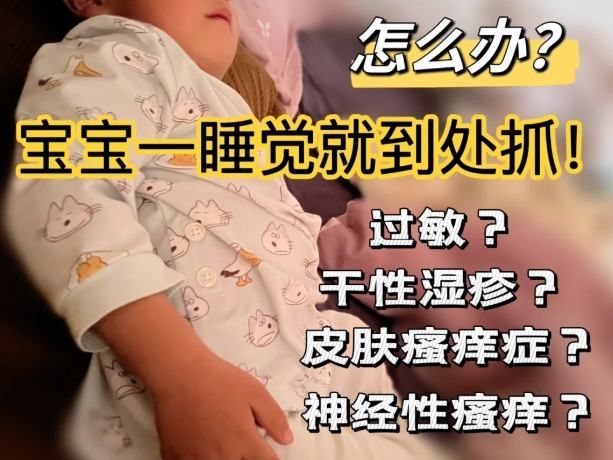 晚上睡觉宝宝老说身上痒的家庭快速止痒妙招